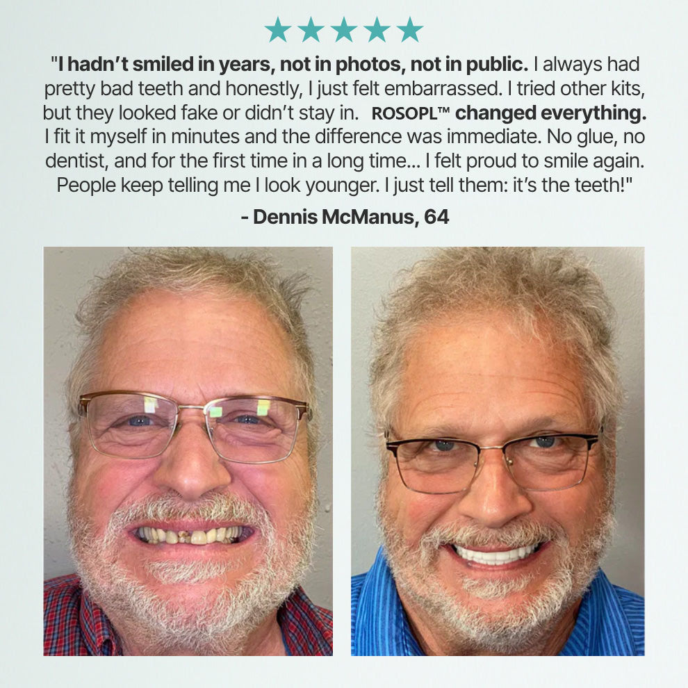 🌎 DULACHTM Custom-Fit Dentures ⏰ ENDS TODAY • 70% OFF | Smile with Confidence