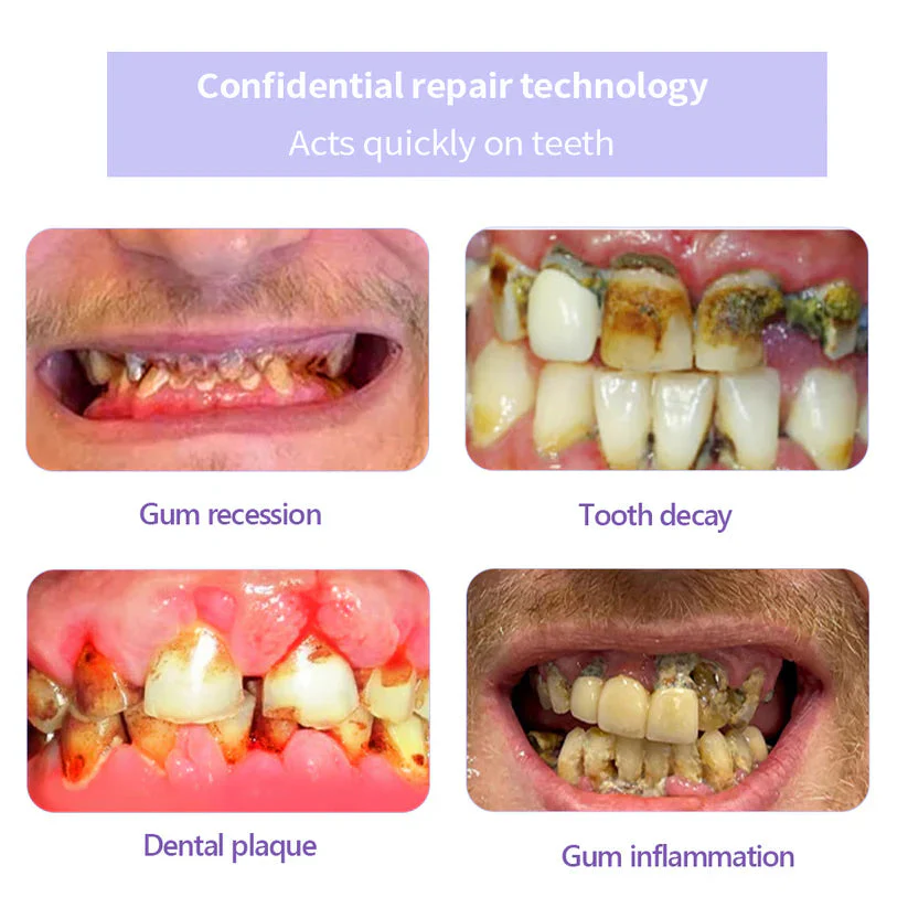 Fivfivgo® Teeth Restoration Mineral Powder