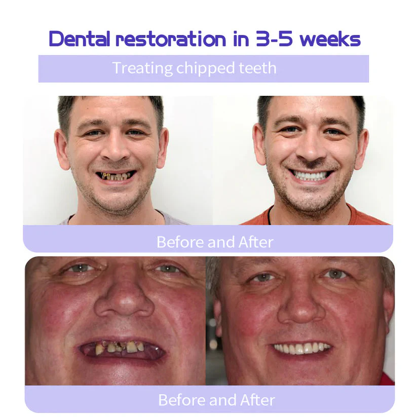 Fivfivgo® Teeth Restoration Mineral Powder