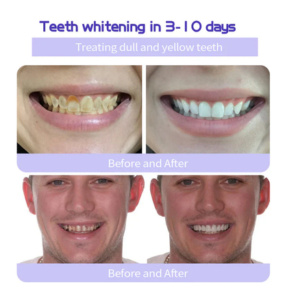 Fivfivgo® Teeth Restoration Mineral Powder