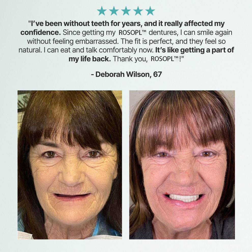 🌎 DULACHTM Custom-Fit Dentures ⏰ ENDS TODAY • 70% OFF | Smile with Confidence